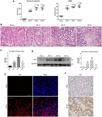 SIX1 Activation Is Involved in Cell Proliferation, Migration, and Anti-inflammation of Acute Ischemia/Reperfusion Injury in Mice